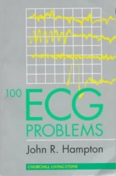 100 Ecg Problems by David Adlam Paperback