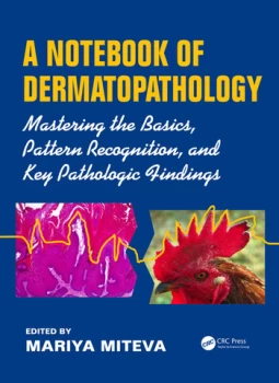 A Notebook of DermatopathologyMastering the Basics Pattern Recognition and Key Pathologic Findings