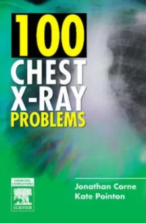 100 chest X-ray problems by Jonathan Corne